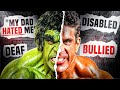 Lou Ferrigno The Disabled Kid Who Terrified Arnold