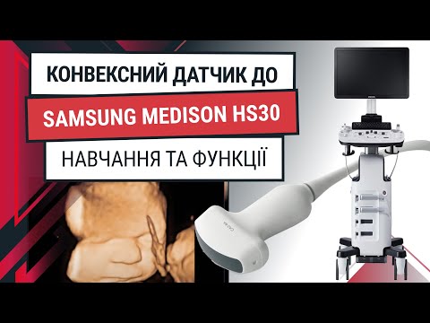 Конвексный датчик для Samsung HS30 – обучение и функции - Статьи RH