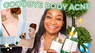 How I Cleared My Body Acne | Body Skincare Products That Changed My Life!
