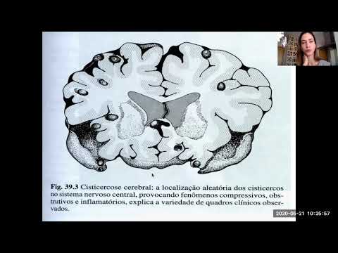 Teníase e cisticercose (parte 2)