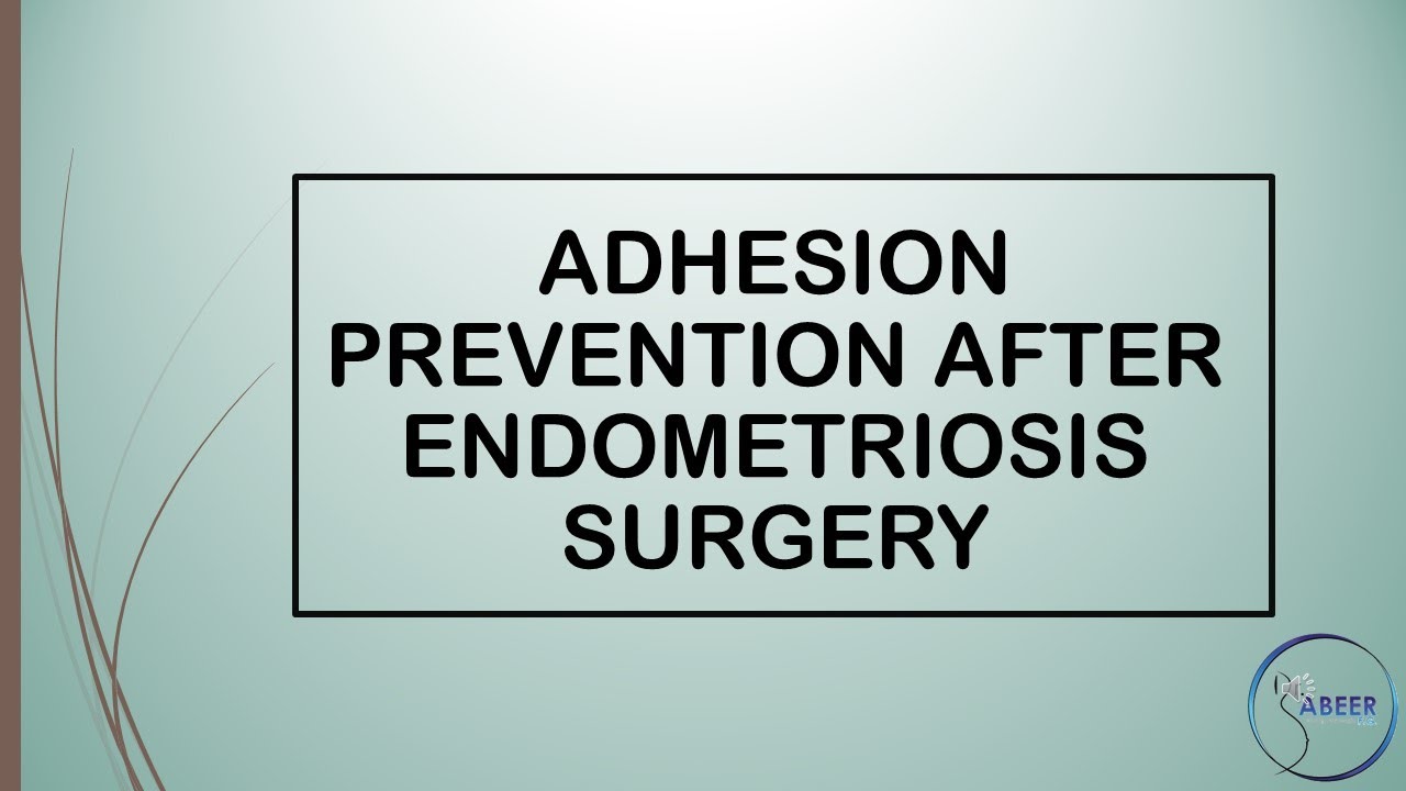 Advanced ObsGyne Lecture ESHRE Guideline Management of Women with Endometriosis Part 2