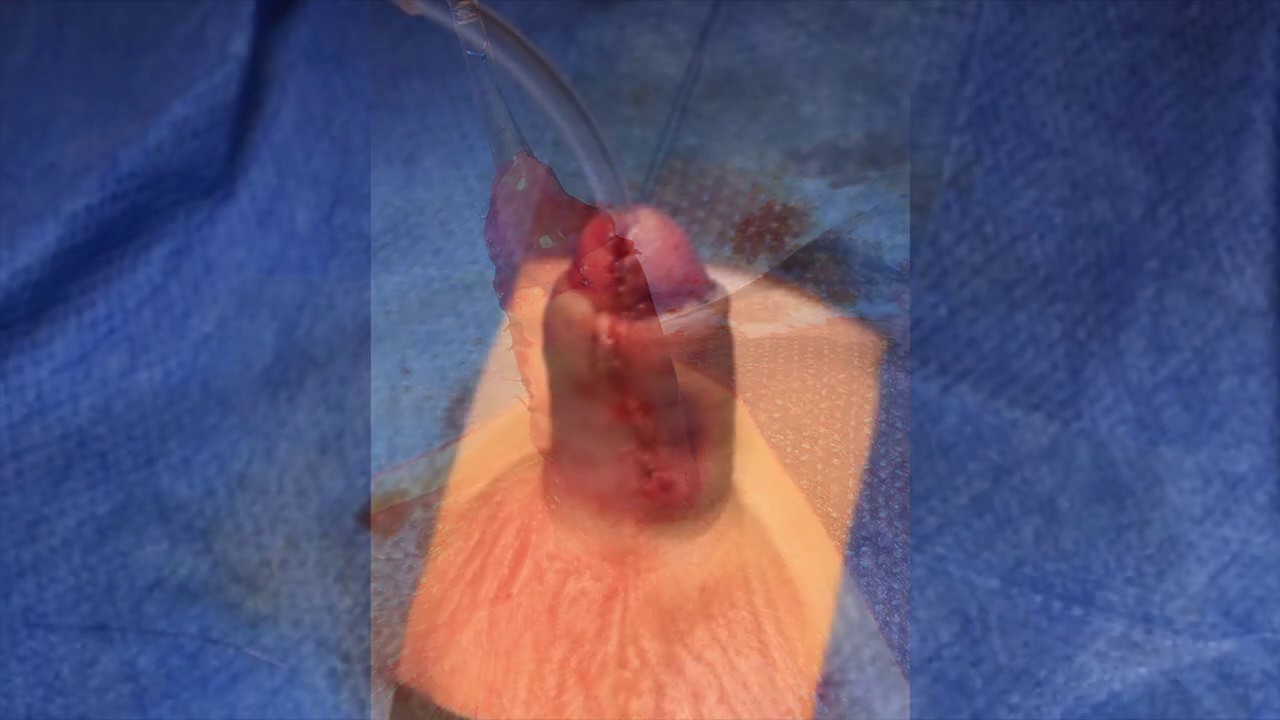 Daniel Cabezali Barbancho-23