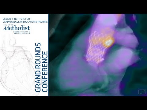 17th Annual Virani Lectureship: Cardiac PET in 2018 (Mouaz Al-Mallah, MD) December 13, 2018