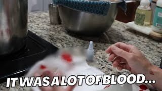 I GLUED My Finger Back together…
