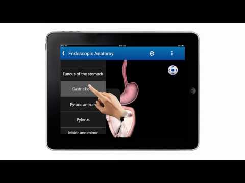 Endoscopy in Dogs (Free) Video