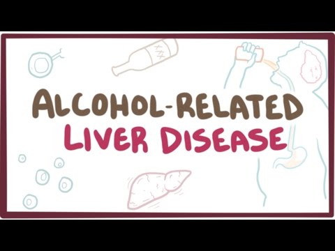Alcohol-related liver disease - causes, symptoms & pathology