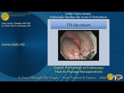 Gastric Perforation at Endoscopy: How to Manage Nonoperatively