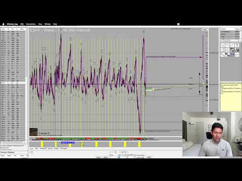 What Exactly Is the Fractal System?