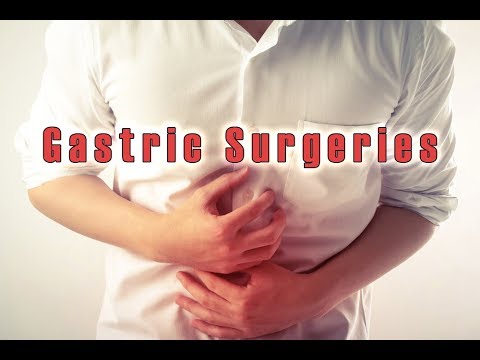 Gastric Surgeries