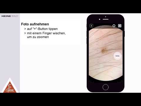 Wie verwende ich die HEINE iC1 Dermatoskop iPhone App