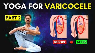 Download lagu Varicocele Exercises Part 2 Follow Along At Home | Yoga for Varicocele #varicocele mp3