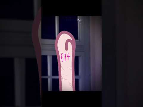 "You shouldn't do this, not even once💀" Cre: @KiaroYun #gacha #gachalife #gachaclub #edit #viral