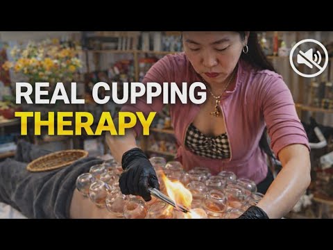 ASMR 🌿 Real Cupping Therapy | Relaxing Natural Sounds | No Talking