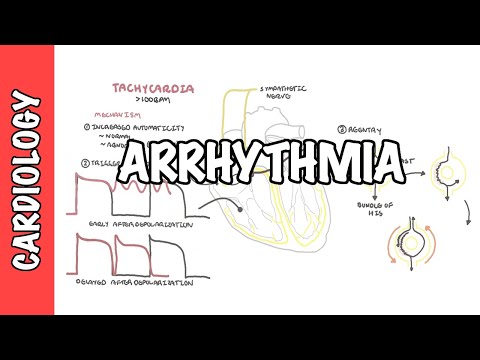 Les arythmies - mécanisme de la bradyarythmie et de la tachyarythmie