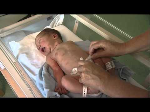 Frimley Health Maternity Unit - Baby's first check - 'top to toe screening'