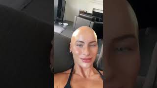 Download lagu WHAT IN THE ALOPECIA IS GOING ON #hairgrowth #alopecia #alopeciaawareness #bald #hairregrowth mp3