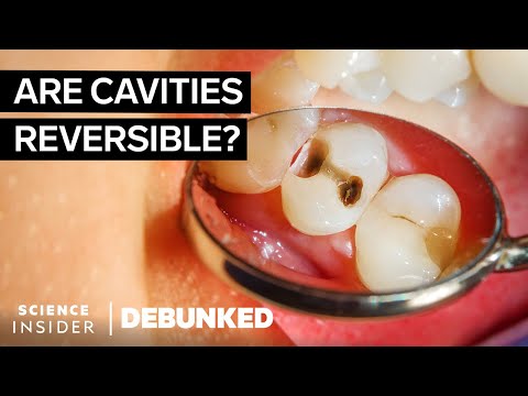 Yet Another 15 Dentistry Myths Busted