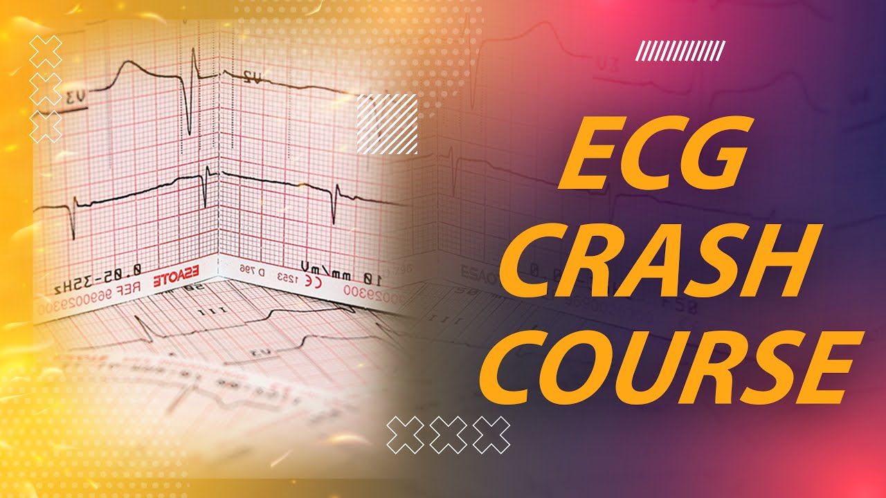 Step 2 CK full guide| Cardiology 4 - ECG part 2