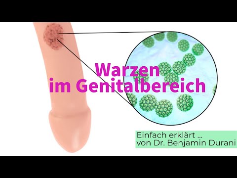 Genital Warts - Cause & Treatment - Simply Explained by Dr. Durani