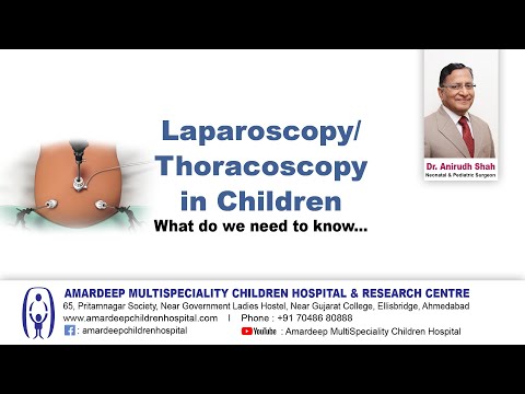 Laparoscopy in Children : English