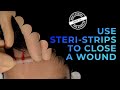How to apply steri-strips to a laceration - wound closure (butterfly)