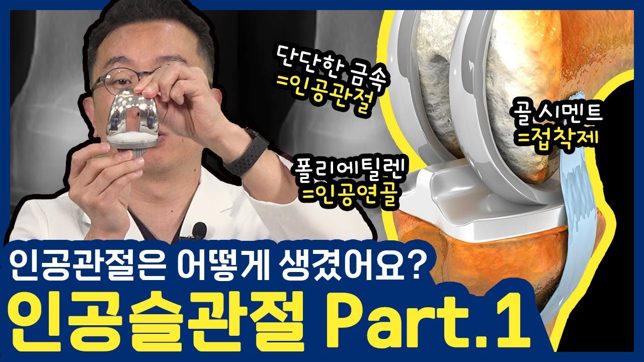 이걸 끼우면 아팠던 무릎이 잘 움직입니다. #인공슬관절 Part 1 (#성남 #성모윌병원) 썸네일 이미지