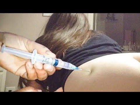 IM Injection Technique in Buttocks|Ceftriaxone & Dexametha|Safe Ventrogluteal Site Guide for Nurses