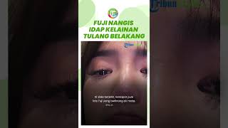 Berlinang Air Mata, Fuji Tangisi Kesehatannya, Eks Thariq Halilintar Idap Kelainan Tulang Belakang