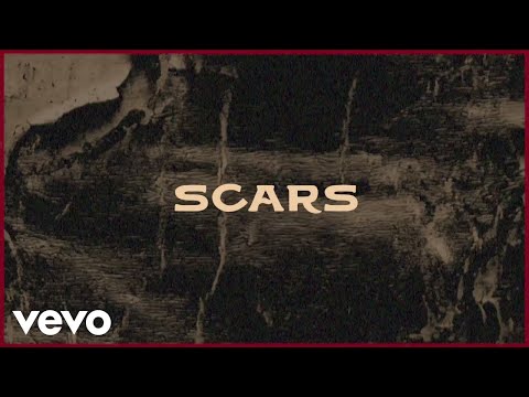 Scotty Hasting - Scars (Lyric Video)