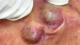 𝑺𝒐𝒐𝒕𝒉𝒊𝒏𝒈 𝑭𝒂𝒄𝒊𝒂𝒍 𝑻𝒓𝒆𝒂𝒕𝒎𝒆𝒏𝒕 𝑭𝒐𝒓 𝑺𝒕𝒓𝒆𝒔𝒔 𝑹𝒆𝒍𝒊𝒆𝒇 𝒂𝒕 𝑳𝒖𝒙𝒖𝒓𝒚 𝑺𝒑𝒂 𝑨𝒄𝒉𝒊𝒆𝒗𝒆 𝑰𝒏𝒏𝒆𝒓 𝑷𝒆𝒂𝒄𝒆 #500466