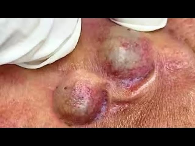 𝑺𝒐𝒐𝒕𝒉𝒊𝒏𝒈 𝑭𝒂𝒄𝒊𝒂𝒍 𝑻𝒓𝒆𝒂𝒕𝒎𝒆𝒏𝒕 𝑭𝒐𝒓 𝑺𝒕𝒓𝒆𝒔𝒔 𝑹𝒆𝒍𝒊𝒆𝒇 𝒂𝒕 𝑳𝒖𝒙𝒖𝒓𝒚 𝑺𝒑𝒂 𝑨𝒄𝒉𝒊𝒆𝒗𝒆 𝑰𝒏𝒏𝒆𝒓 𝑷𝒆𝒂𝒄𝒆 #500466