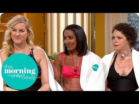 The Disfigured Models Embracing Their Shapes, Sizes and Scars | This Morning