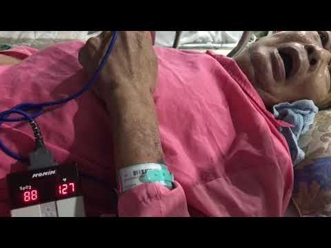 Cheyne Stoke respiration (nhịp thở Cheyne Stoke)