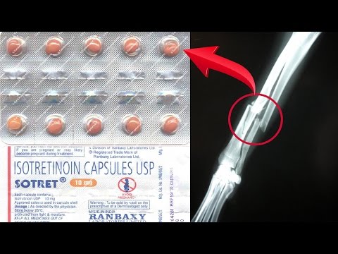 Milyen gyógyszerek a kerekes féregek számára, Kerekes féreg tabletta Kerekesférgek