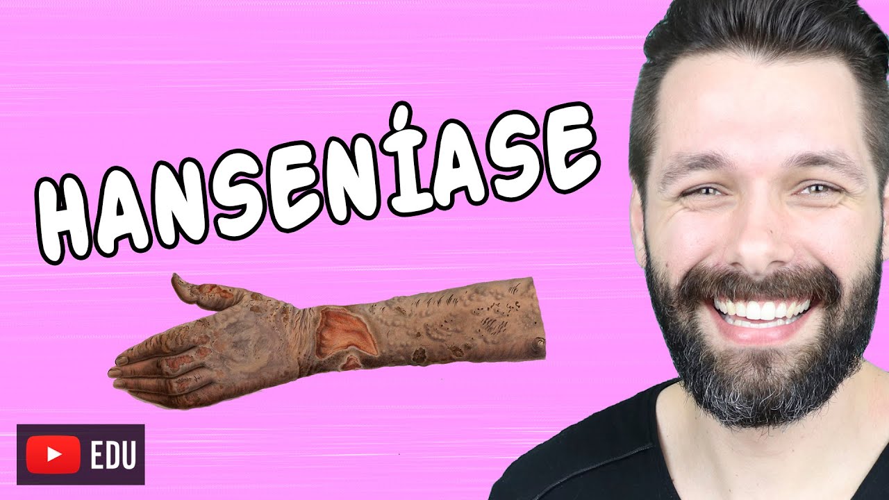 HANSENÍASE - Lepra | Biologia com Samuel Cunha