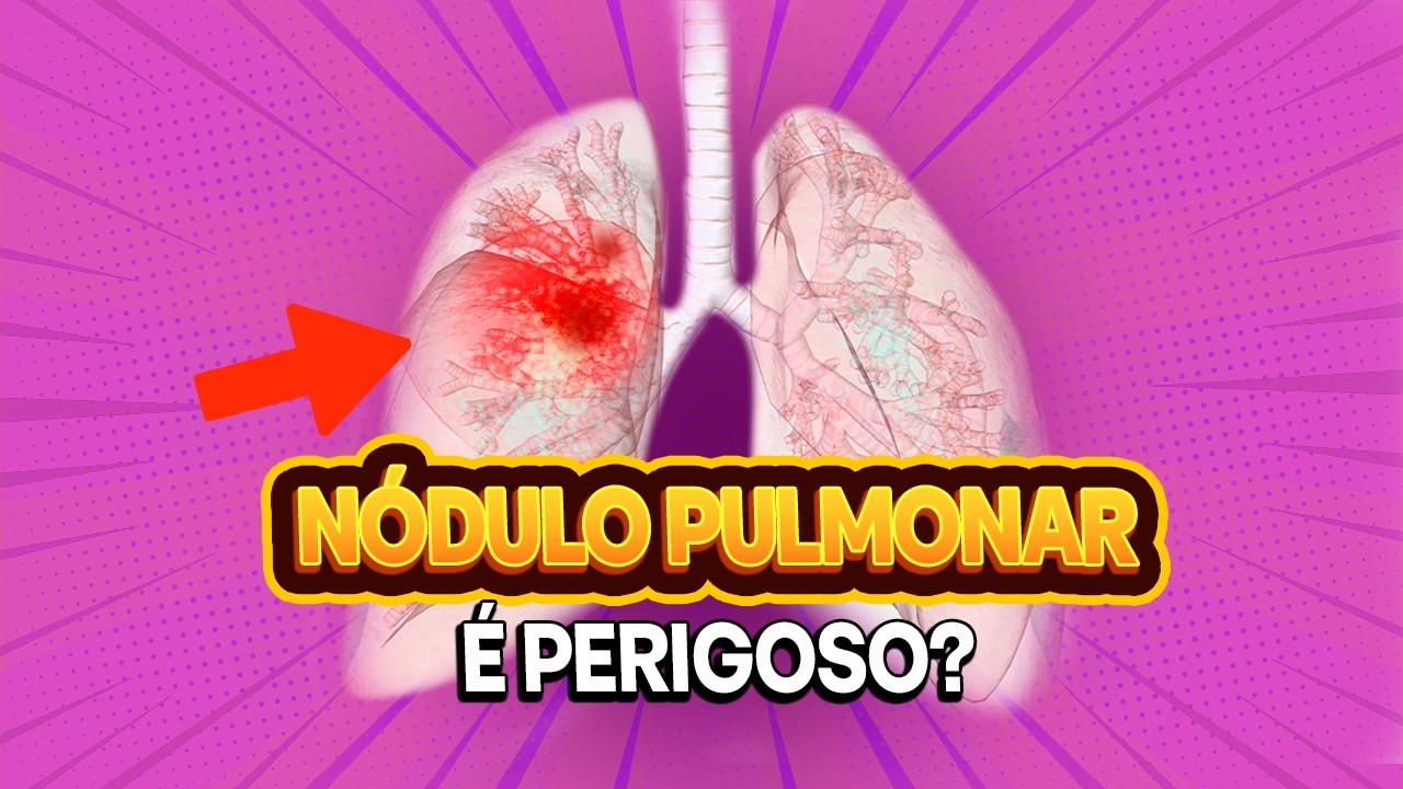 Descobri um Nódulo no Pulmão: Isso é Perigoso?