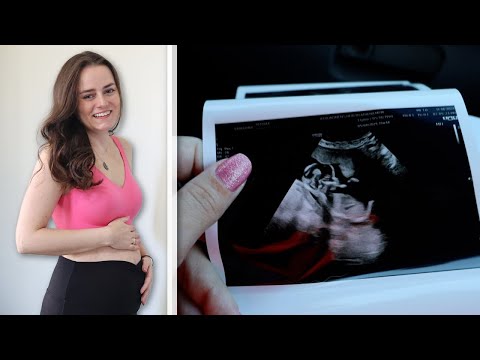 16 Week Anatomy Ultrasound a Little Bit Early! | 15 Weeks Pregnant | Let's Talk IBD