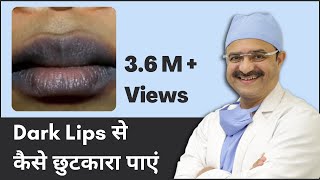 Dark Lips Treatment: How to Get Rid of Dark Lips (Dark Lips से कैसे छुटकारा पाएं) | (In HINDI)