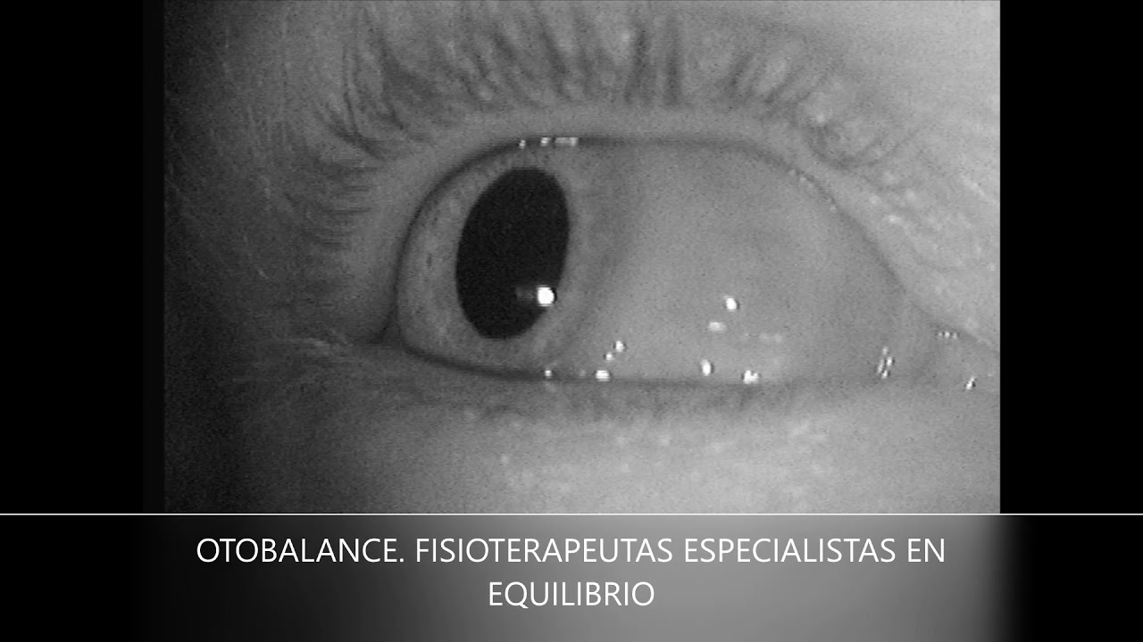 Experto en Fisioterapia Vestibular en el marco de los trastornos del equilibrio