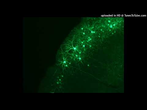 (FREE) Nardo Wick x Future Type Beat "NEOCORTEX"