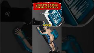 COMO É FEITA A CIRURGIA DE ESCOLIOSE #saude #saudavel #escoliose #curiosidades