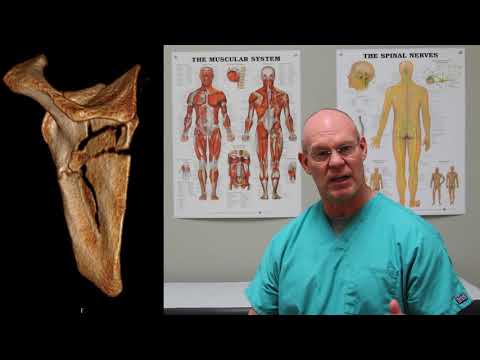 Shoulder Blade (Scapula) Fractures | Fracture Friday Episode 29