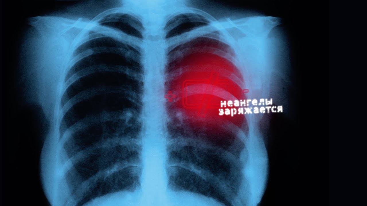 НеАнгелы — Заряжается