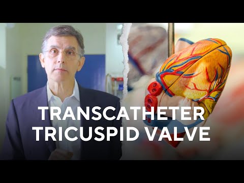 Transfemoral Transcatheter Tricuspid Valve Replacement (TTVR) | Prof David Muller