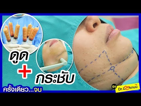 ข่าวในการรักษาโรคสะเก็ดเงินที่เล็บ รักษากลาก discoid