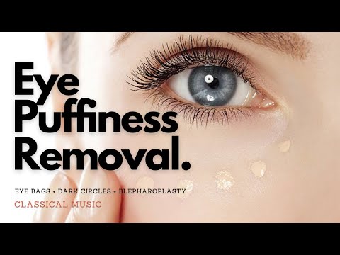 𝄞 Powerful Blepharoplasty! ~ Remove Eye Puffiness + Eye Bags + Dark Circles ~ Classical Music
