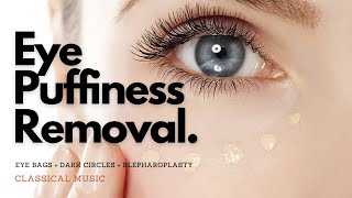 𝄞 Powerful Blepharoplasty! ~ Remove Eye Puffiness + Eye Bags + Dark Circles ~ Classical Music