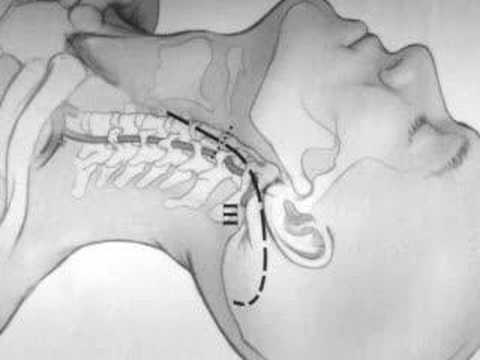 comment soulager l'arthrose de la colonne vertébrale