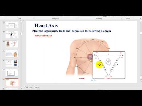 Part 4 ECG Heart Axis And Axis Deviation  محاور القلب