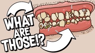 GROSS SPORTS SURGERY! GROSSEST GAME EVER! - Super Sports Surgery: Rugby